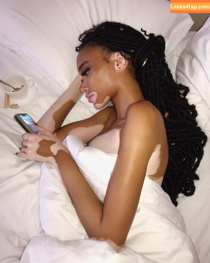 Winnie Harlow / winnieharlow leaked photo photo #0125