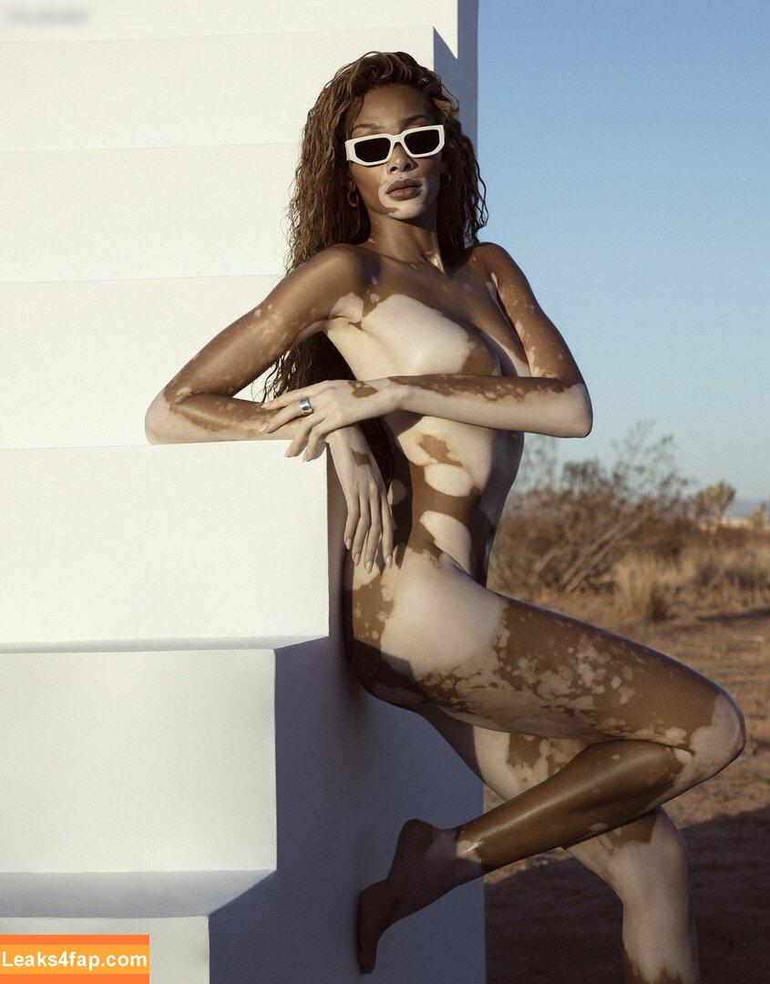 Winnie Harlow / winnieharlow leaked photo photo #0127