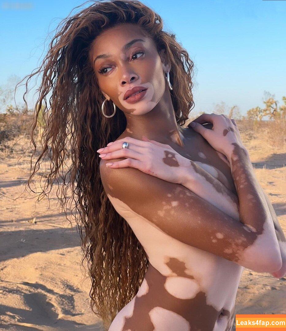 Winnie Harlow / winnieharlow leaked photo photo #0129