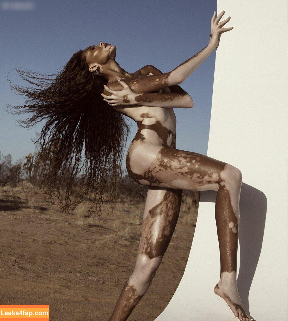 Winnie Harlow / winnieharlow слитое фото фото #0131