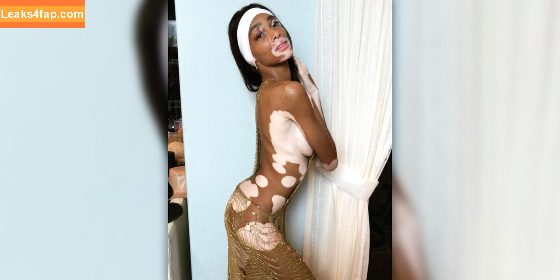 Winnie Harlow / winnieharlow слитое фото фото #0140