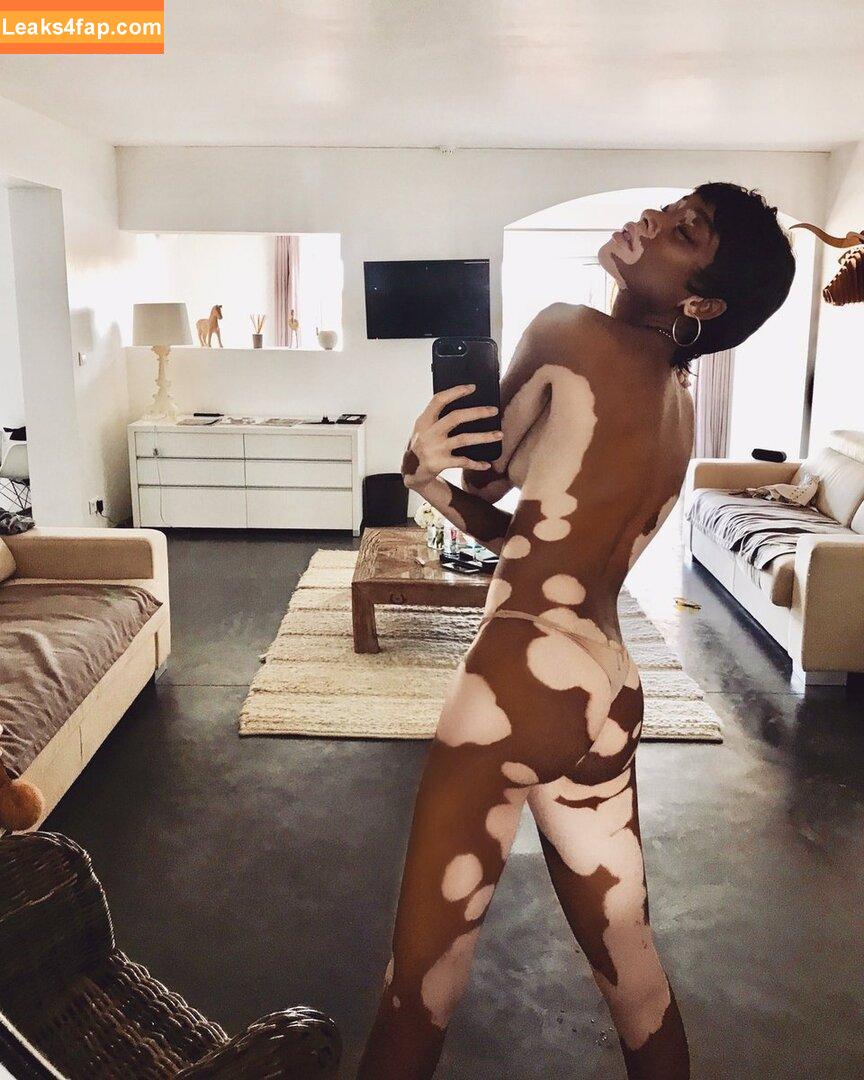 Winnie Harlow / winnieharlow leaked photo photo #0141