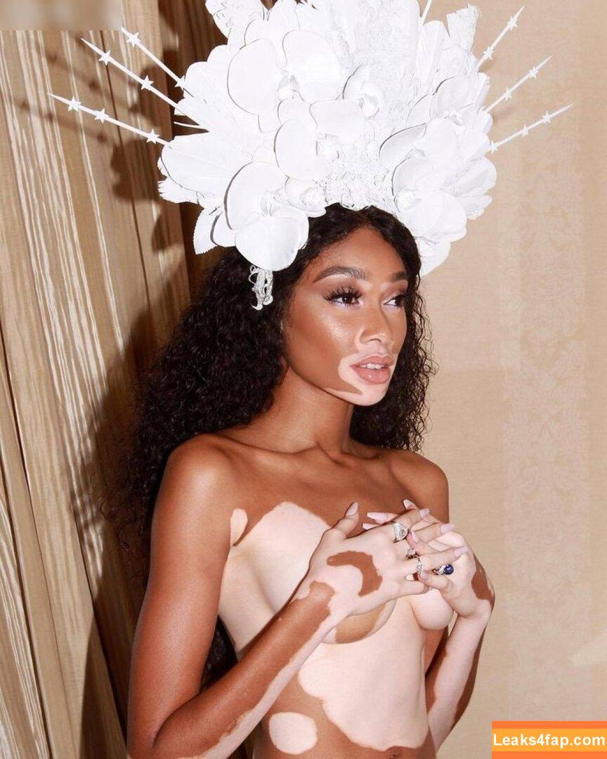 Winnie Harlow / winnieharlow leaked photo photo #0142