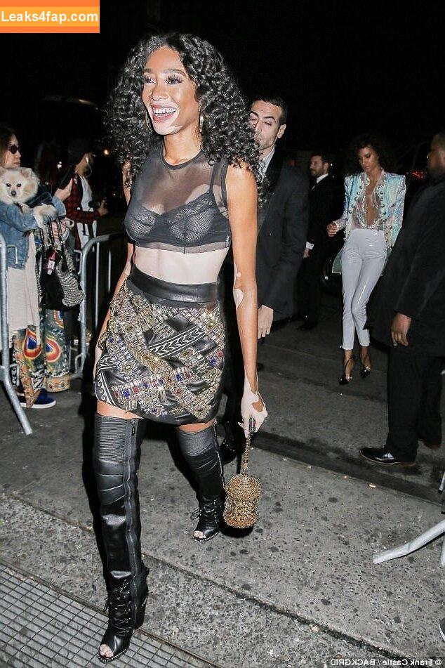 Winnie Harlow / winnieharlow leaked photo photo #0143