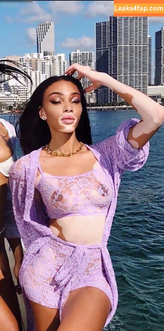 Winnie Harlow / winnieharlow leaked photo photo #0151