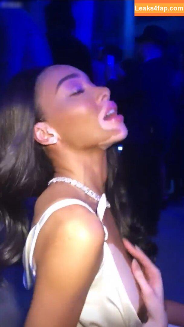 Winnie Harlow / winnieharlow leaked photo photo #0153