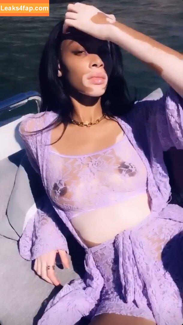 Winnie Harlow / winnieharlow leaked photo photo #0156