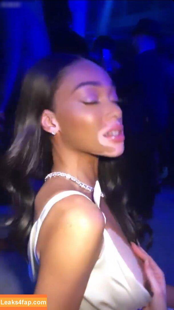 Winnie Harlow / winnieharlow leaked photo photo #0159