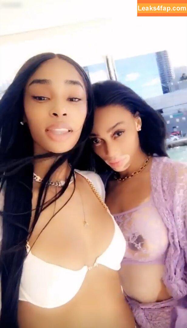 Winnie Harlow / winnieharlow leaked photo photo #0161