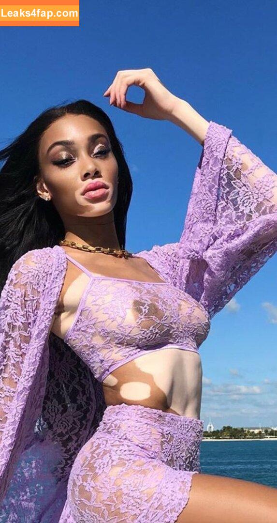 Winnie Harlow / winnieharlow слитое фото фото #0162