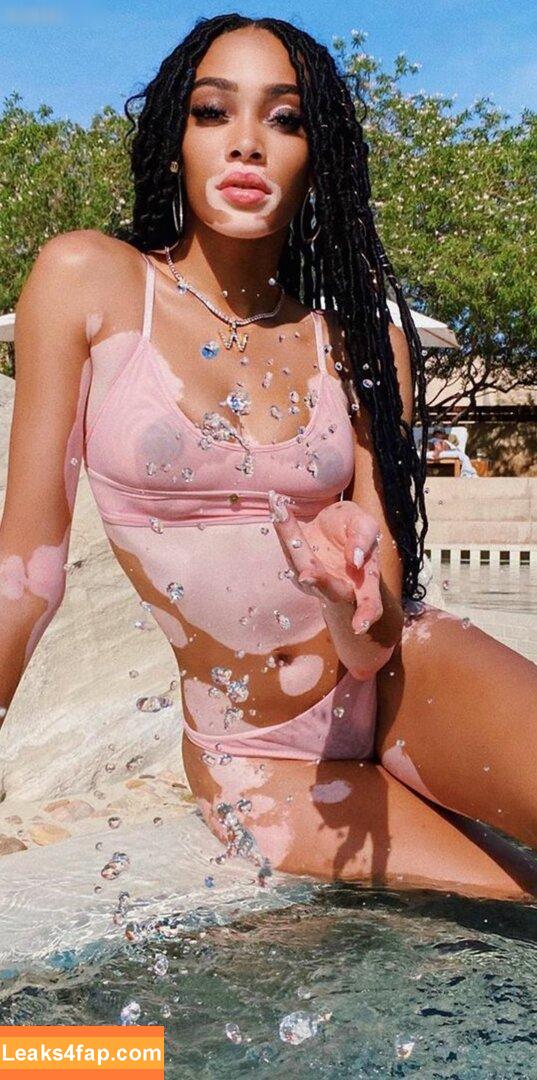 Winnie Harlow / winnieharlow leaked photo photo #0165