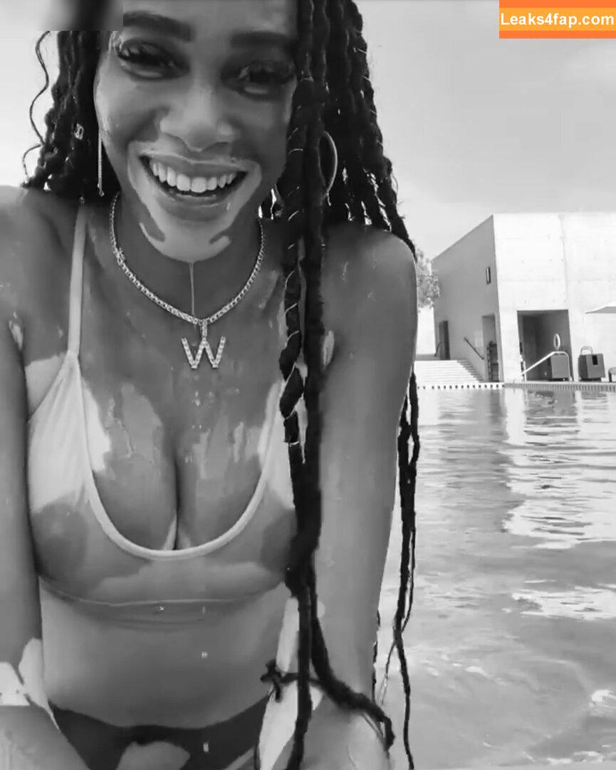 Winnie Harlow / winnieharlow слитое фото фото #0166