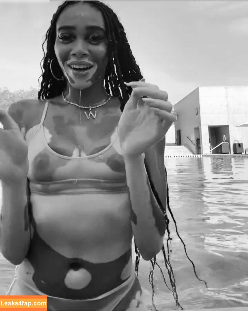 Winnie Harlow / winnieharlow leaked photo photo #0167