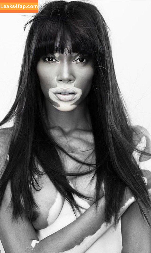 Winnie Harlow / winnieharlow слитое фото фото #0170