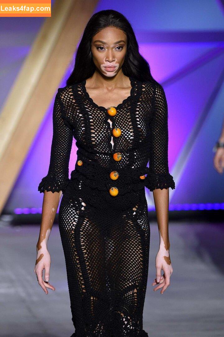 Winnie Harlow / winnieharlow leaked photo photo #0196