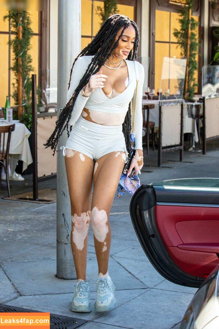 Winnie Harlow / winnieharlow leaked photo photo #0217