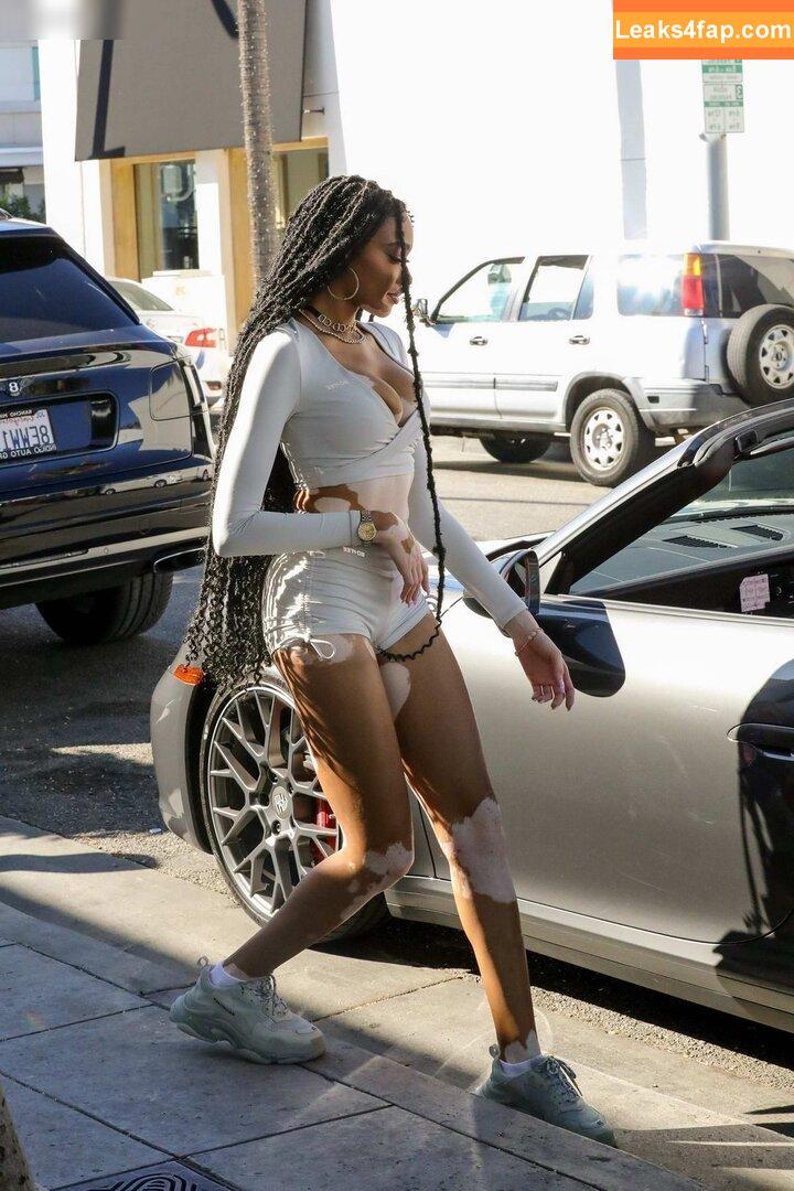 Winnie Harlow / winnieharlow leaked photo photo #0220