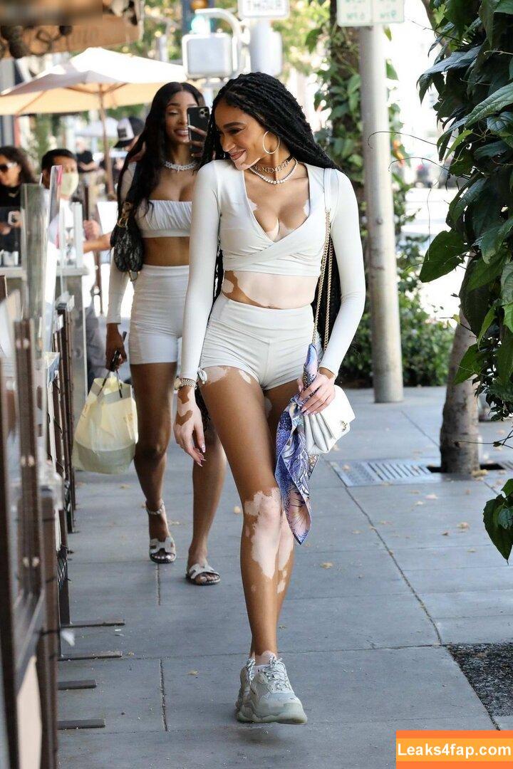 Winnie Harlow / winnieharlow leaked photo photo #0228