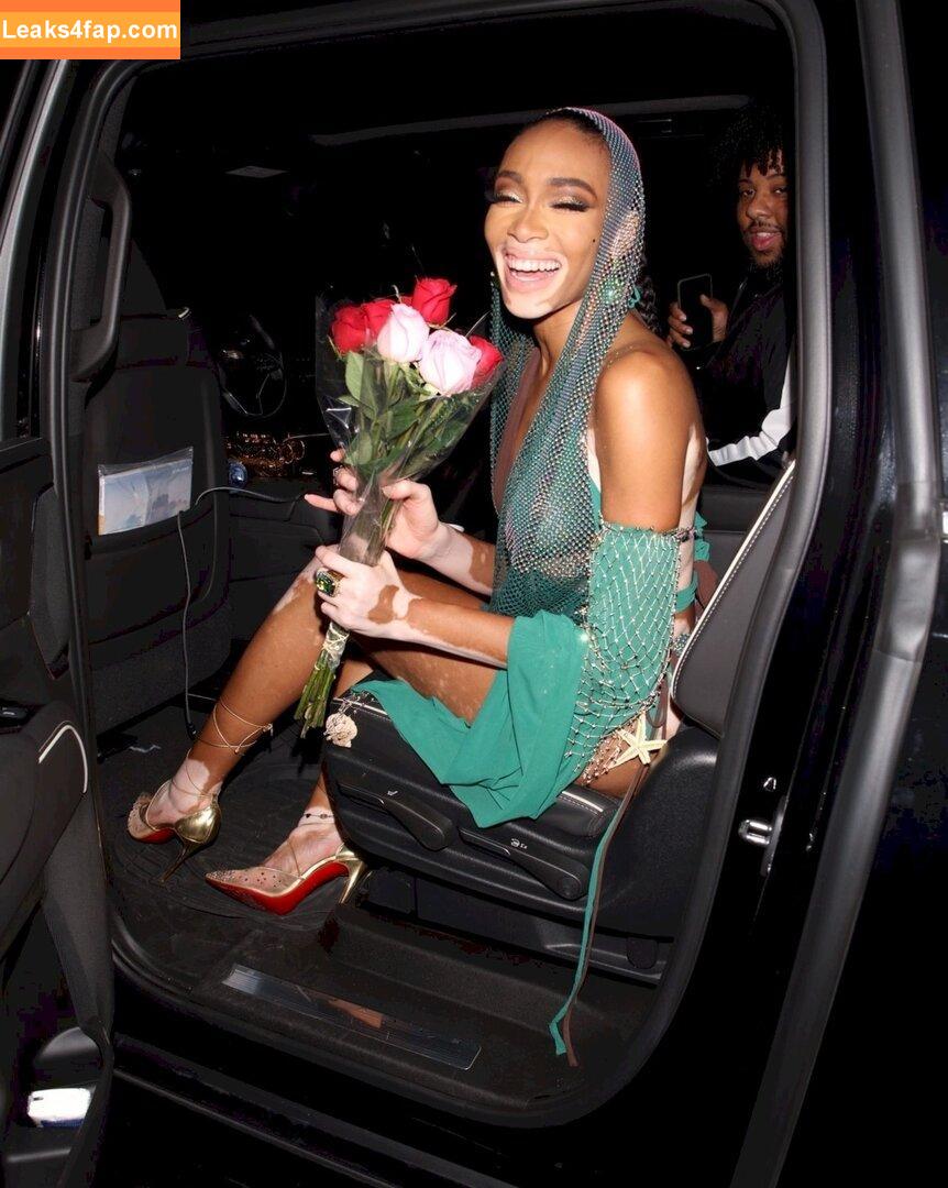 Winnie Harlow / winnieharlow leaked photo photo #0277