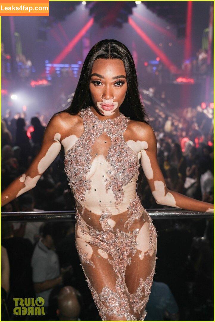 Winnie Harlow / winnieharlow слитое фото фото #0329