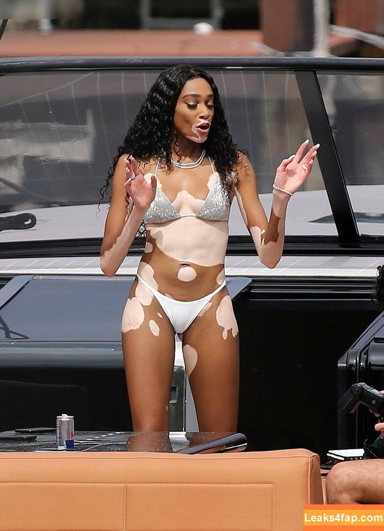 Winnie Harlow / winnieharlow leaked photo photo #0332