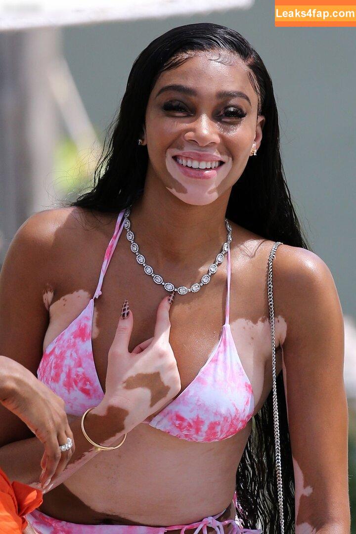 Winnie Harlow / winnieharlow leaked photo photo #0365