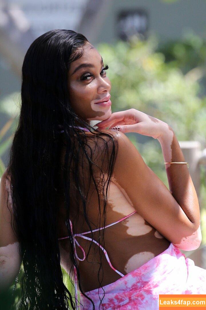 Winnie Harlow / winnieharlow leaked photo photo #0366