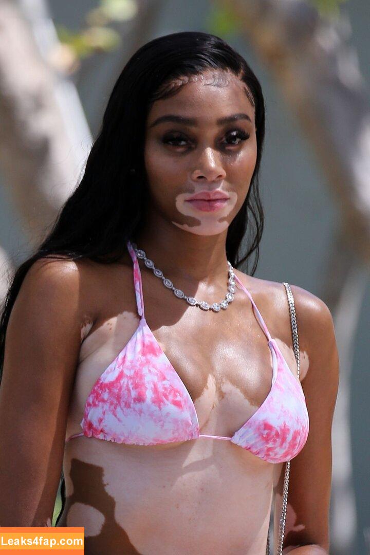 Winnie Harlow / winnieharlow leaked photo photo #0370