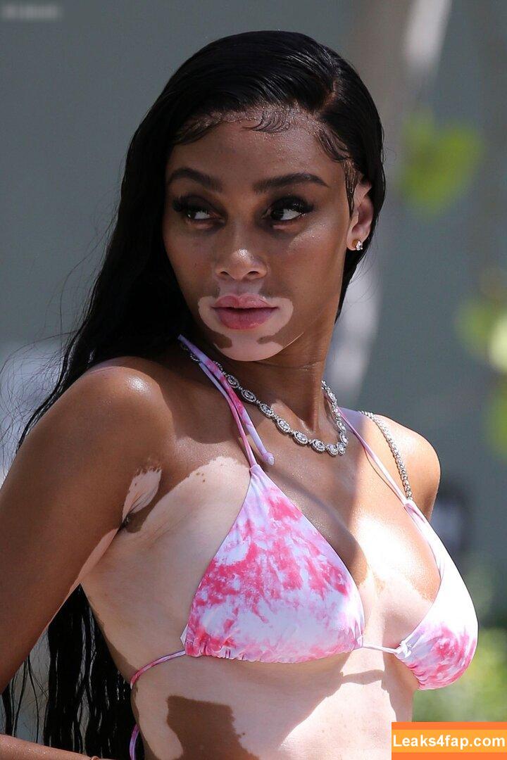 Winnie Harlow / winnieharlow слитое фото фото #0371