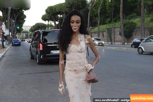 Winnie Harlow / winnieharlow слитое фото фото #0391