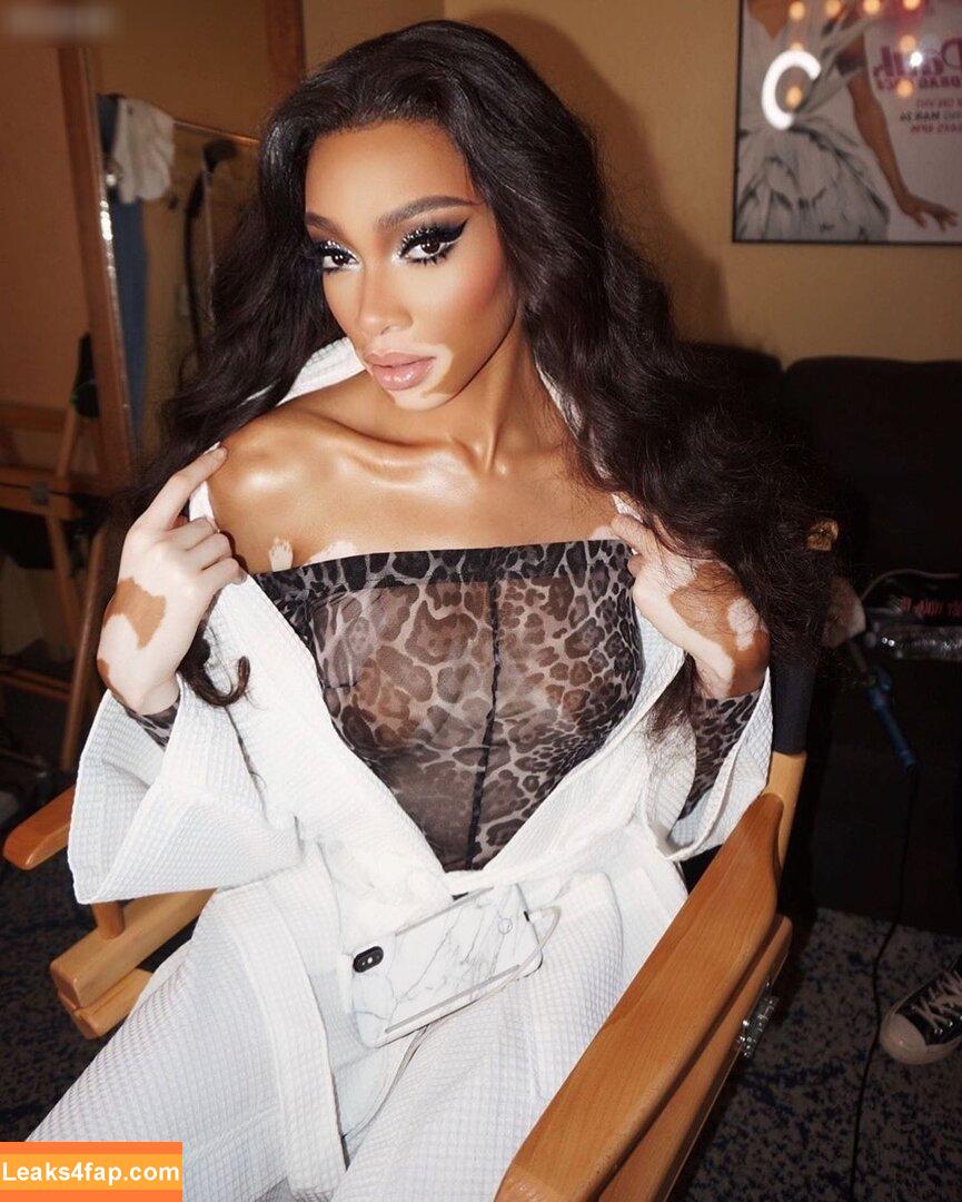 Winnie Harlow / winnieharlow leaked photo photo #0392