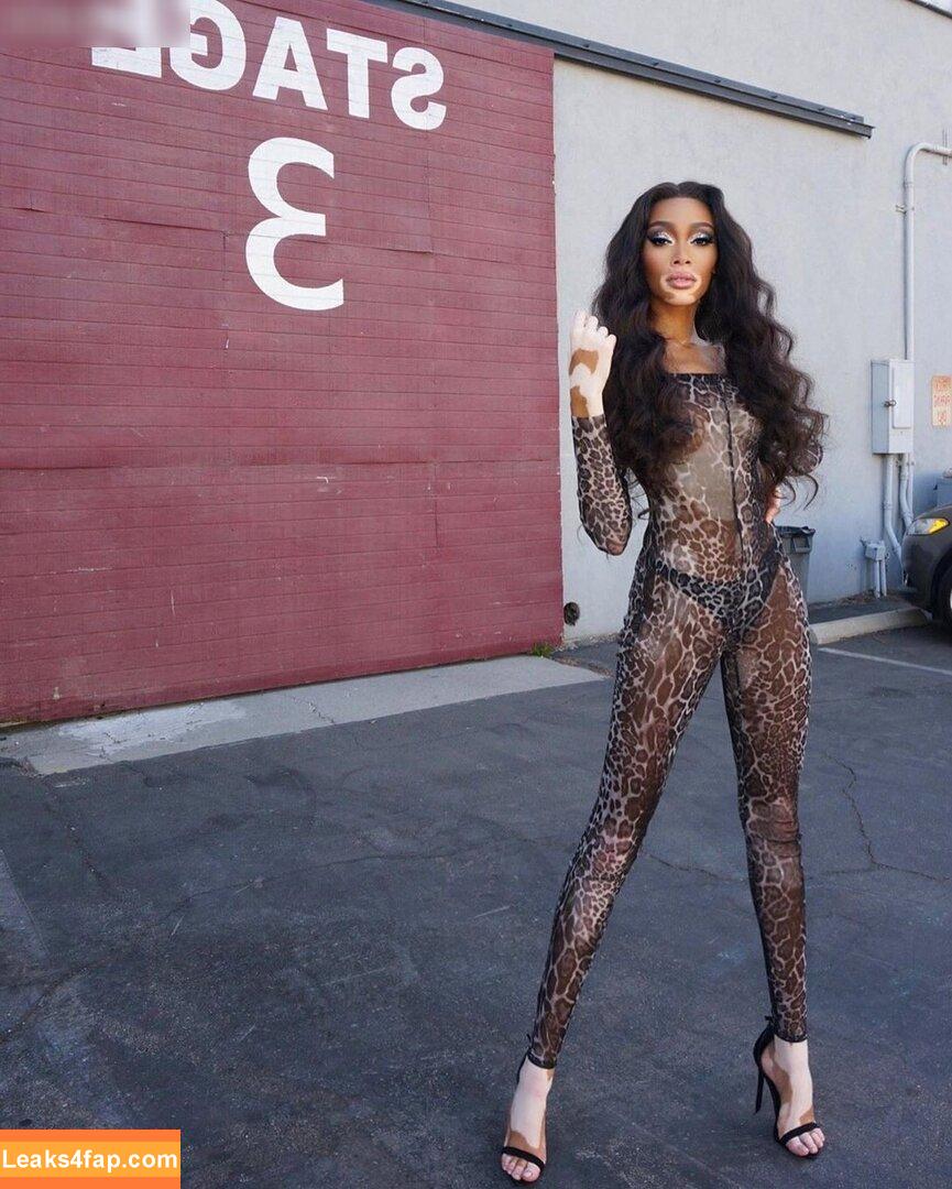 Winnie Harlow / winnieharlow leaked photo photo #0395