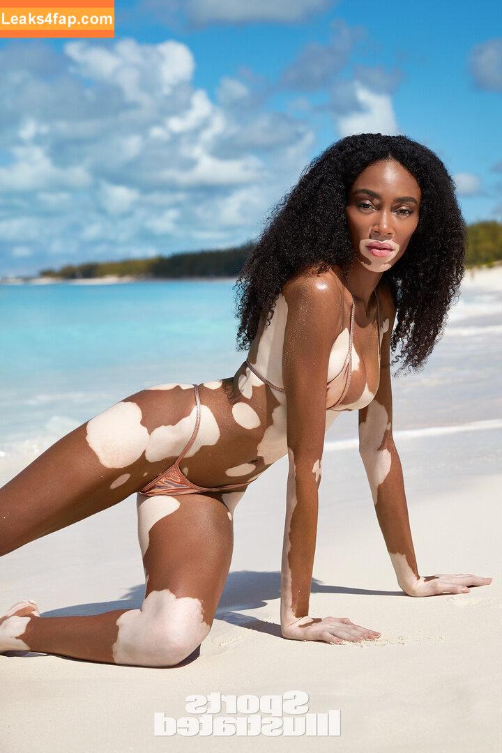 Winnie Harlow / winnieharlow слитое фото фото #0419