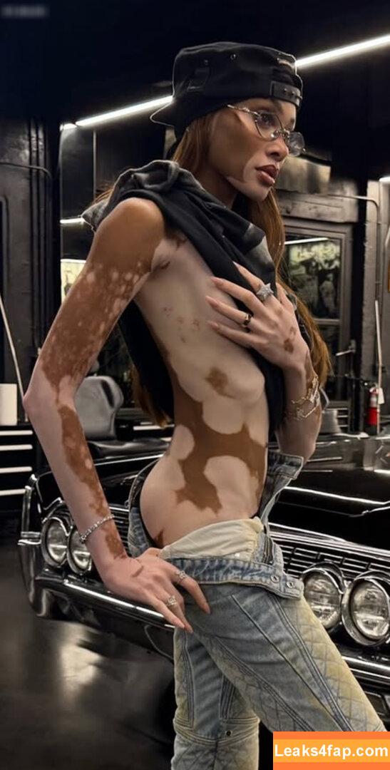 Winnie Harlow / winnieharlow leaked photo photo #0450