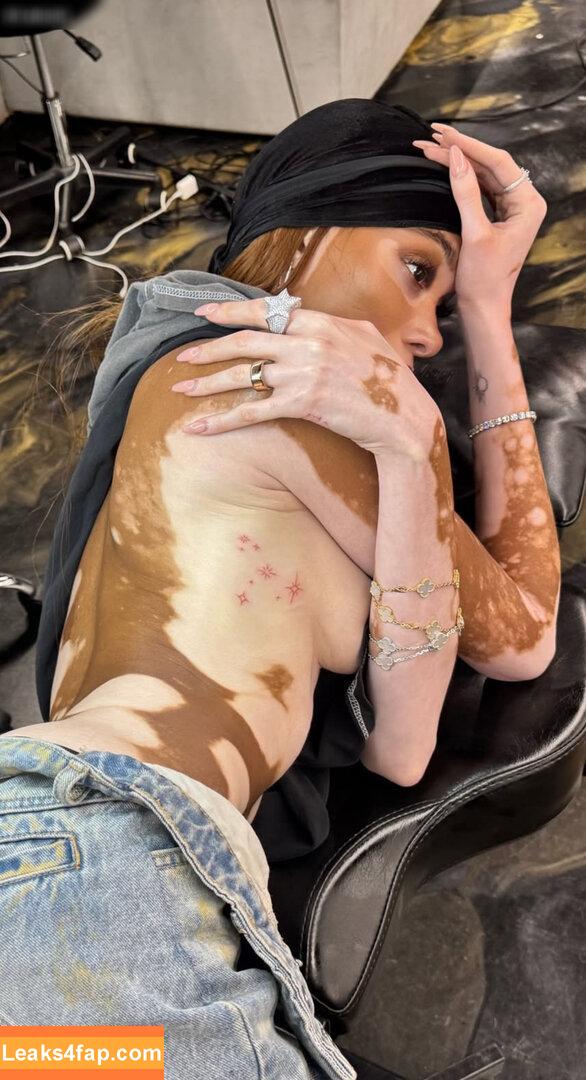 Winnie Harlow / winnieharlow leaked photo photo #0451