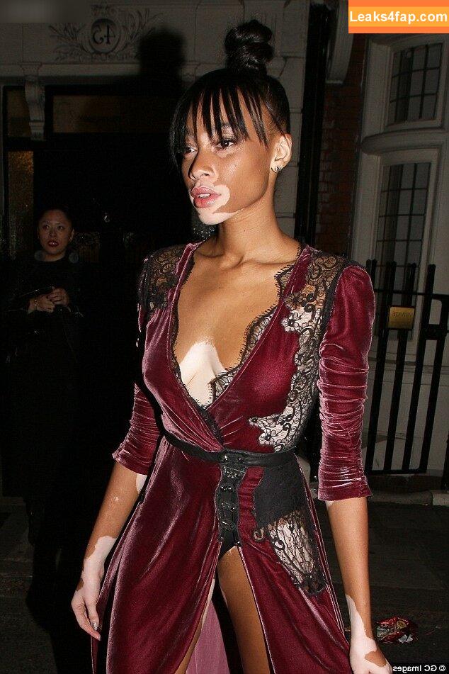 Winnie Harlow / winnieharlow leaked photo photo #0472