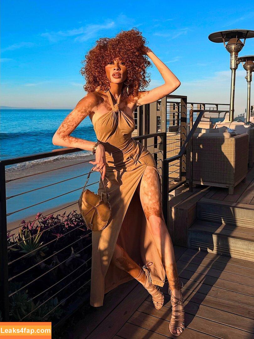 Winnie Harlow / https: / winnieharlow leaked photo photo #0473