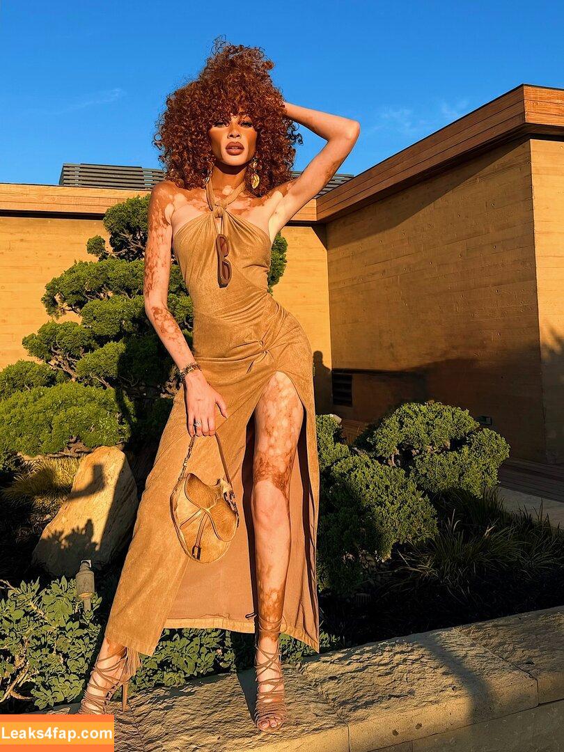 Winnie Harlow / https: / winnieharlow leaked photo photo #0476