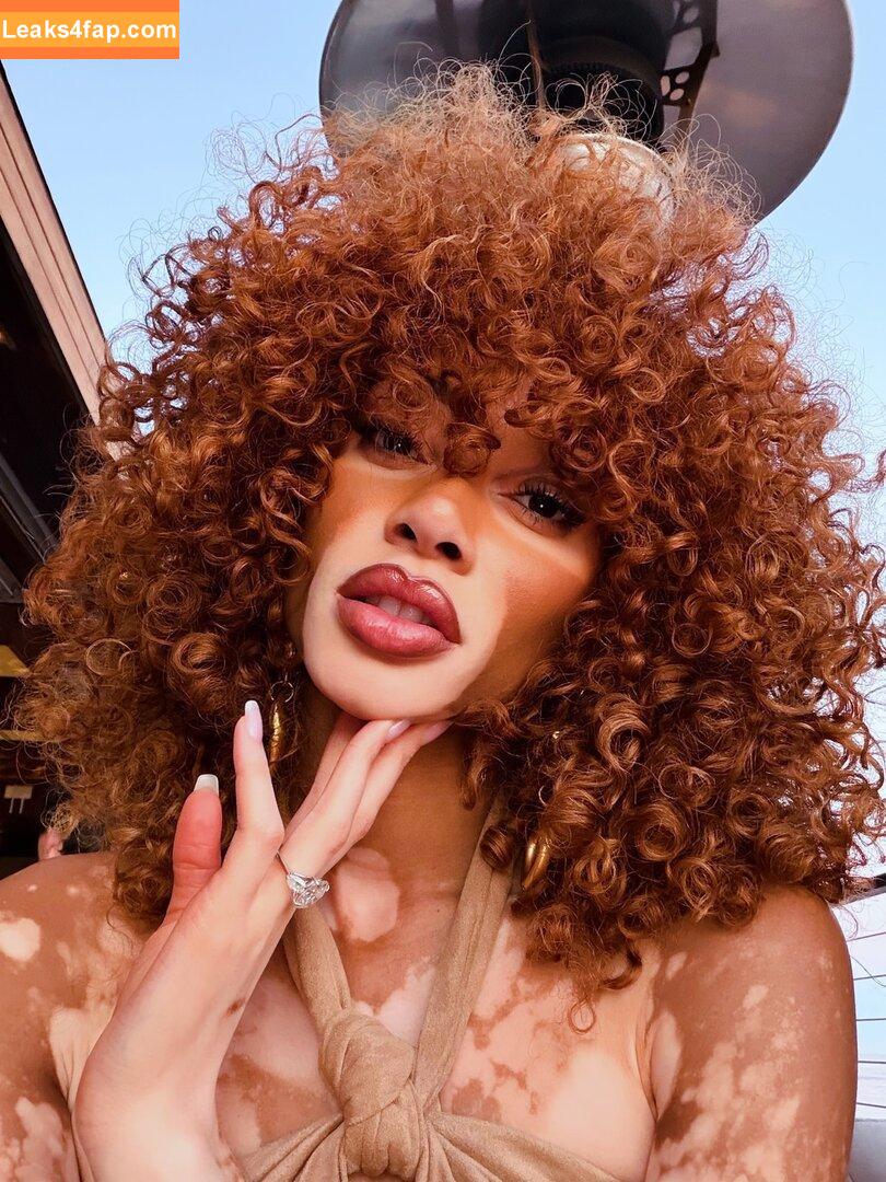 Winnie Harlow / https: / winnieharlow leaked photo photo #0477