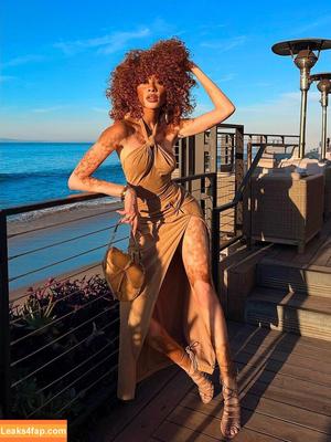 Winnie Harlow photo #0473