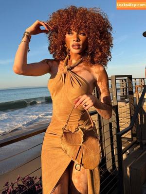 Winnie Harlow photo #0475