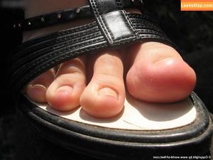 Worldoffeet photo #2215