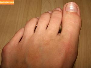 Worldoffeet photo #3093